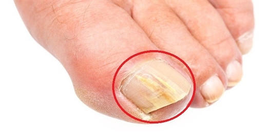 Chỉ cần nhìn bàn chân đã có thể giải mã được bí mật về sức khỏe Chi can nhin ban chan da co the giai ma duoc bi mat ve suc khoe