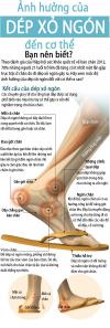 DÉP XỎ NGÓN ( Flip Flop ).